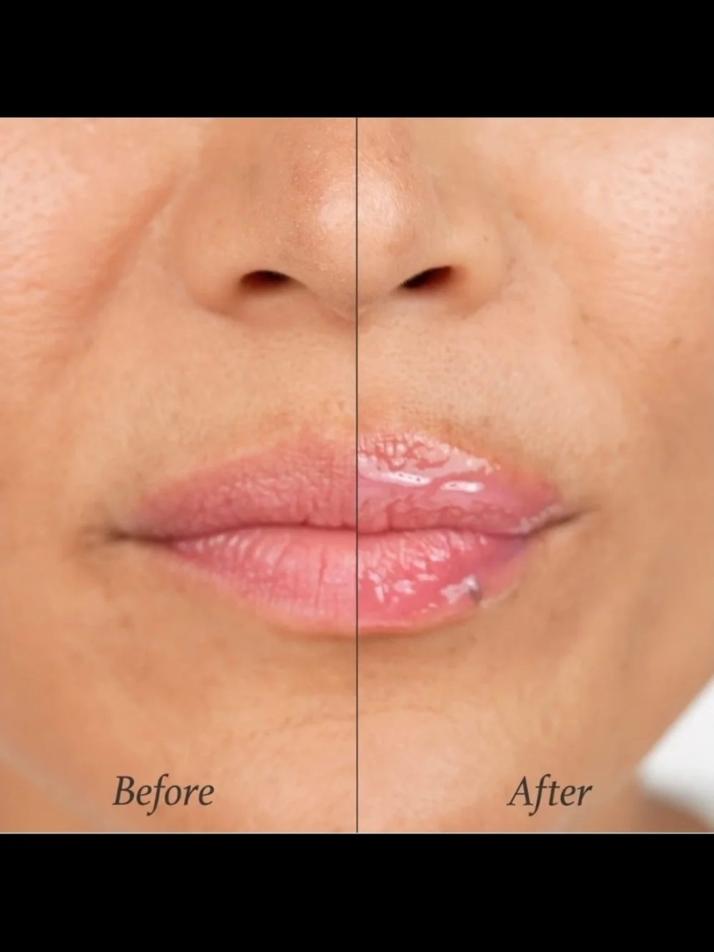 Julep 24 lip